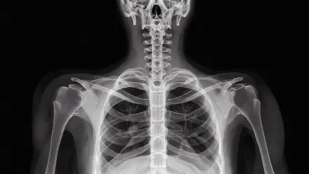 4K Ultra HD X-ray wallpaper of a human skeleton’s rib cage, shoulders, and upper spine against a black background.