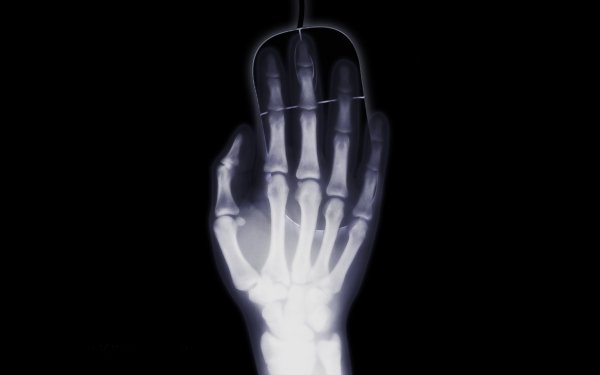 Photography X-ray Bones Hand Minimalist Humor Black X-ray vision Mouse HD Wallpaper | Background Image